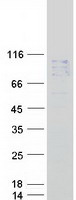 NAALAD2 Protein - Purified recombinant protein NAALAD2 was analyzed by SDS-PAGE gel and Coomassie Blue Staining