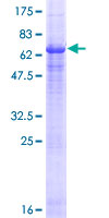 NAALADL2 Protein - 12.5% SDS-PAGE of human NAALADL2 stained with Coomassie Blue