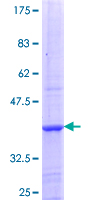 NAALADL2 Protein - 12.5% SDS-PAGE Stained with Coomassie Blue.