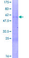 NAB2 Protein - 12.5% SDS-PAGE of human NAB2 stained with Coomassie Blue