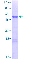 NABP2 Protein - 12.5% SDS-PAGE of human OBFC2B stained with Coomassie Blue