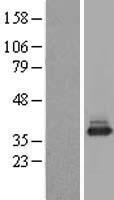 NACA Protein - Western validation with an anti-DDK antibody * L: Control HEK293 lysate R: Over-expression lysate