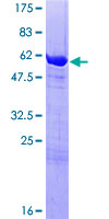NACA Protein - 12.5% SDS-PAGE of human NACA stained with Coomassie Blue