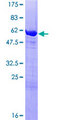NACA Protein - 12.5% SDS-PAGE of human NACA stained with Coomassie Blue