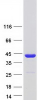NACA Protein - Purified recombinant protein NACA was analyzed by SDS-PAGE gel and Coomassie Blue Staining