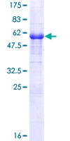 NACA2 Protein - 12.5% SDS-PAGE of human NACA2 stained with Coomassie Blue