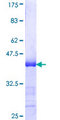 NACA2 Protein - 12.5% SDS-PAGE Stained with Coomassie Blue.