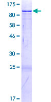 NACC2 / BTBD14A Protein - 12.5% SDS-PAGE of human BTBD14A stained with Coomassie Blue