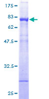 NADK / NAD Kinase Protein - 12.5% SDS-PAGE of human FLJ13052 stained with Coomassie Blue