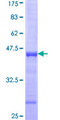 NADK / NAD Kinase Protein - 12.5% SDS-PAGE Stained with Coomassie Blue.