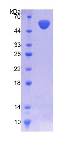 NADK / NAD Kinase Protein - Recombinant  NAD Kinase By SDS-PAGE