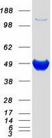 NADK / NAD Kinase Protein - Purified recombinant protein NADK was analyzed by SDS-PAGE gel and Coomassie Blue Staining