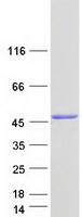 NADK2 / C5orf33 Protein - Purified recombinant protein NADK2 was analyzed by SDS-PAGE gel and Coomassie Blue Staining