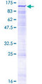 NADSYN1 / NAD Synthetase Protein - 12.5% SDS-PAGE of human NADSYN1 stained with Coomassie Blue