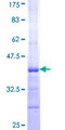 NADSYN1 / NAD Synthetase Protein - 12.5% SDS-PAGE Stained with Coomassie Blue.