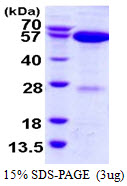 NAE1 / APPBP1 Protein