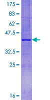 NAF-1 / CISD2 Protein - 12.5% SDS-PAGE of human CISD2 stained with Coomassie Blue