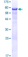 NAG20 / UBAP1 Protein - 12.5% SDS-PAGE of human UBAP1 stained with Coomassie Blue