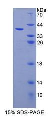 NAG20 / UBAP1 Protein - Recombinant Ubiquitin Associated Protein 1 By SDS-PAGE