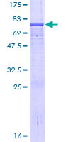 NAGA Protein - 12.5% SDS-PAGE of human NAGA stained with Coomassie Blue