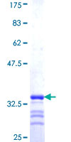 NAGK Protein - 12.5% SDS-PAGE Stained with Coomassie Blue.