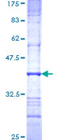 NAGLU Protein - 12.5% SDS-PAGE Stained with Coomassie Blue.