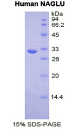 NAGLU Protein - Recombinant  N-Acetyl Alpha-D-Glucosaminidase By SDS-PAGE