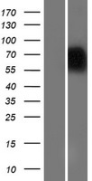 NAGPA Protein - Western validation with an anti-DDK antibody * L: Control HEK293 lysate R: Over-expression lysate