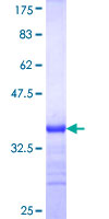NAGPA Protein - 12.5% SDS-PAGE Stained with Coomassie Blue.