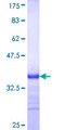 NAGPA Protein - 12.5% SDS-PAGE Stained with Coomassie Blue.