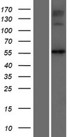 NAGS Protein - Western validation with an anti-DDK antibody * L: Control HEK293 lysate R: Over-expression lysate