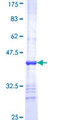NAGS Protein - 12.5% SDS-PAGE Stained with Coomassie Blue.