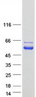 NAGS Protein - Purified recombinant protein NAGS was analyzed by SDS-PAGE gel and Coomassie Blue Staining