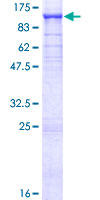 NAK / TBK1 Protein - 12.5% SDS-PAGE of human TBK1 stained with Coomassie Blue