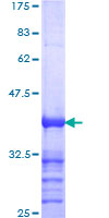 NAK / TBK1 Protein - 12.5% SDS-PAGE Stained with Coomassie Blue.