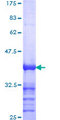 NAK / TBK1 Protein - 12.5% SDS-PAGE Stained with Coomassie Blue.