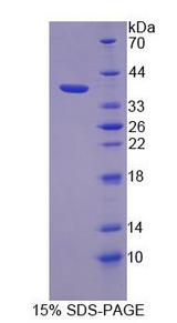 NAK / TBK1 Protein - Recombinant  TANK Binding Kinase 1 By SDS-PAGE