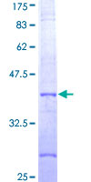 NALP3 / NLRP3 Protein - 12.5% SDS-PAGE Stained with Coomassie Blue.