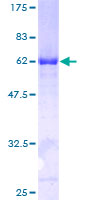 NAMPT / Visfatin Protein - 12.5% SDS-PAGE of human NAMPT stained with Coomassie Blue