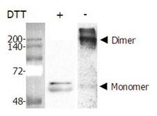 NAMPT / Visfatin Protein - Dimer formation of recombinant Nampt (Visfatin, PBEF) (AG-40A-0018). Purified Nampt (Visfatin, PBEF) was separated by SDS-PAGE and Western blot analysis was performed using rabbit anti-Nampt polyclonal antibody (AG-25A-0025). In the absence of DTT, Nampt (visfatin, PBEF) formed a homodimer, a homomultimer.