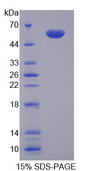 NAMPT / Visfatin Protein - Recombinant Visfatin By SDS-PAGE