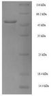 NANOG Protein - (Tris-Glycine gel) Discontinuous SDS-PAGE (reduced) with 5% enrichment gel and 15% separation gel.