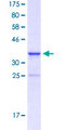 NANOG Protein - 12.5% SDS-PAGE Stained with Coomassie Blue.