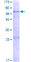 NANOG Protein - 12.5% SDS-PAGE Stained with Coomassie Blue
