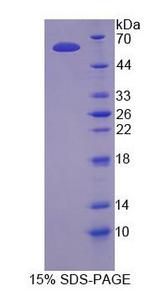 NANOG Protein - Recombinant  NANOG Homeobox Protein By SDS-PAGE