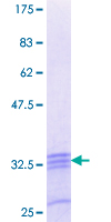 NANOS2 / NOS2 Protein - 12.5% SDS-PAGE Stained with Coomassie Blue.