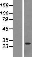 NANOS3 / NOS-3 Protein - Western validation with an anti-DDK antibody * L: Control HEK293 lysate R: Over-expression lysate