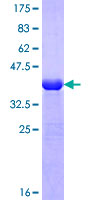 NANOS3 / NOS-3 Protein - 12.5% SDS-PAGE Stained with Coomassie Blue.