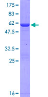 NANP Protein - 12.5% SDS-PAGE of human NANP stained with Coomassie Blue