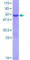 NANP Protein - 12.5% SDS-PAGE of human NANP stained with Coomassie Blue